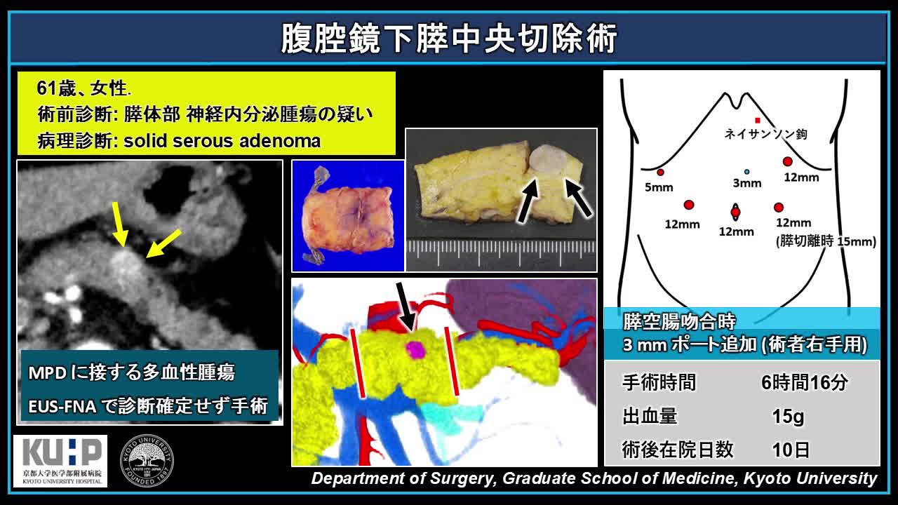 日鏡外会誌 31巻1号 video articles（長井論文）...