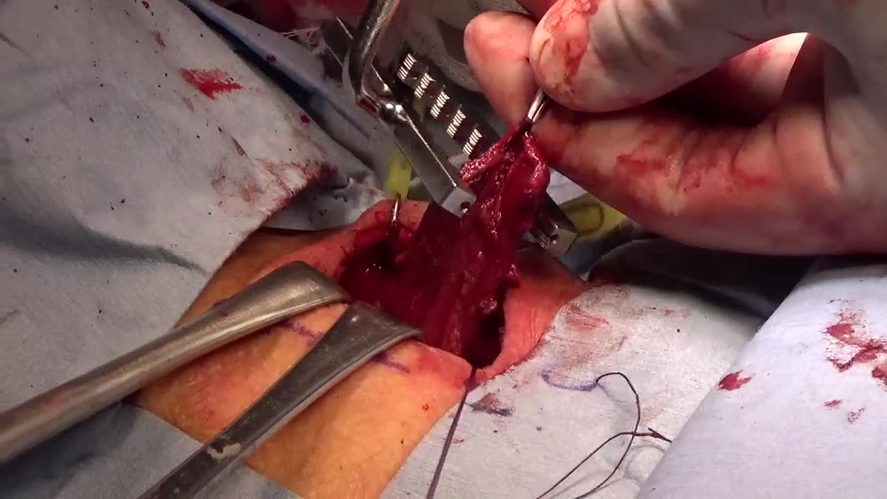 日鏡外会誌 31巻2号 video articles（河口論文）...