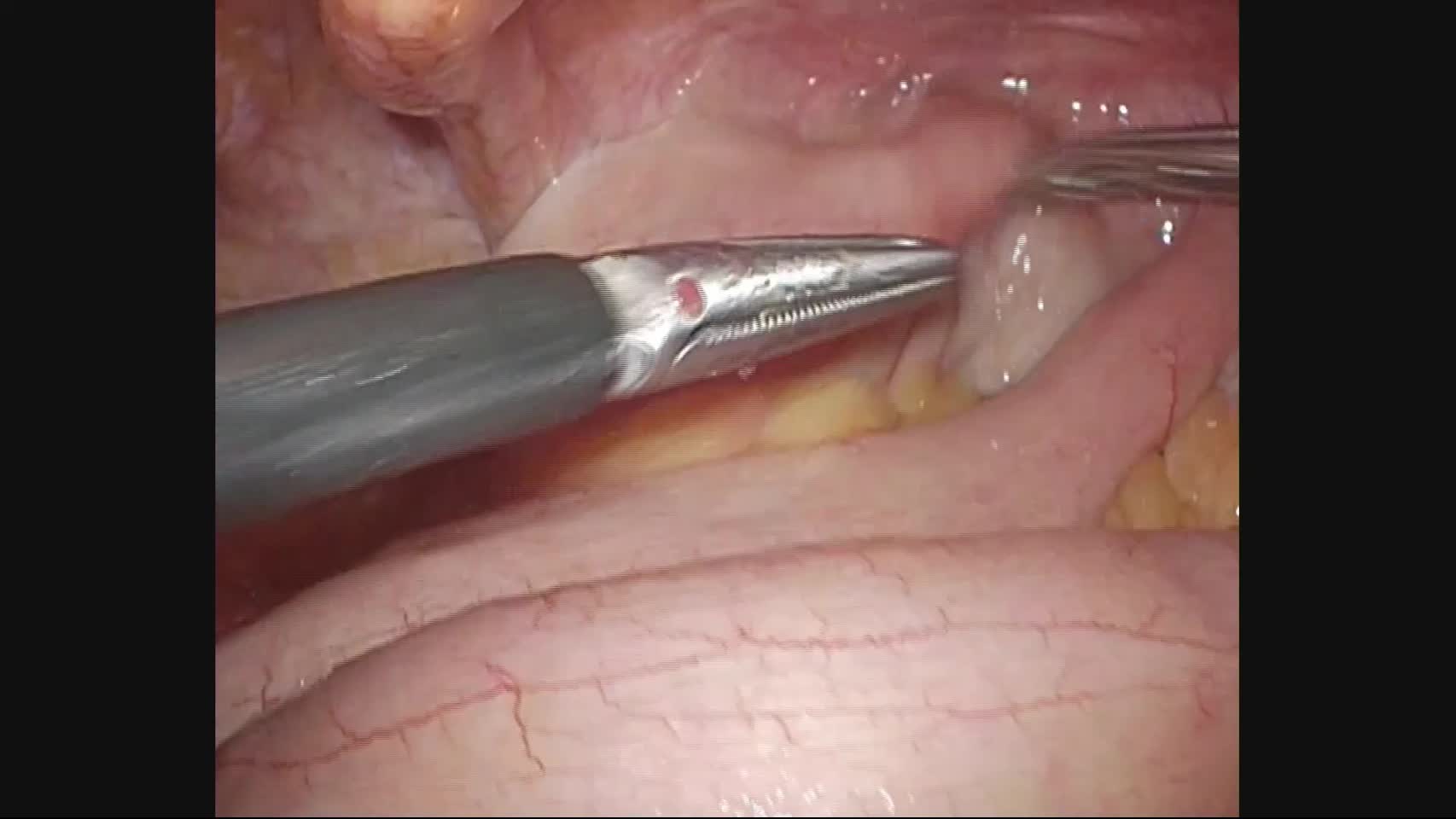 （ES）4625：飯島論文