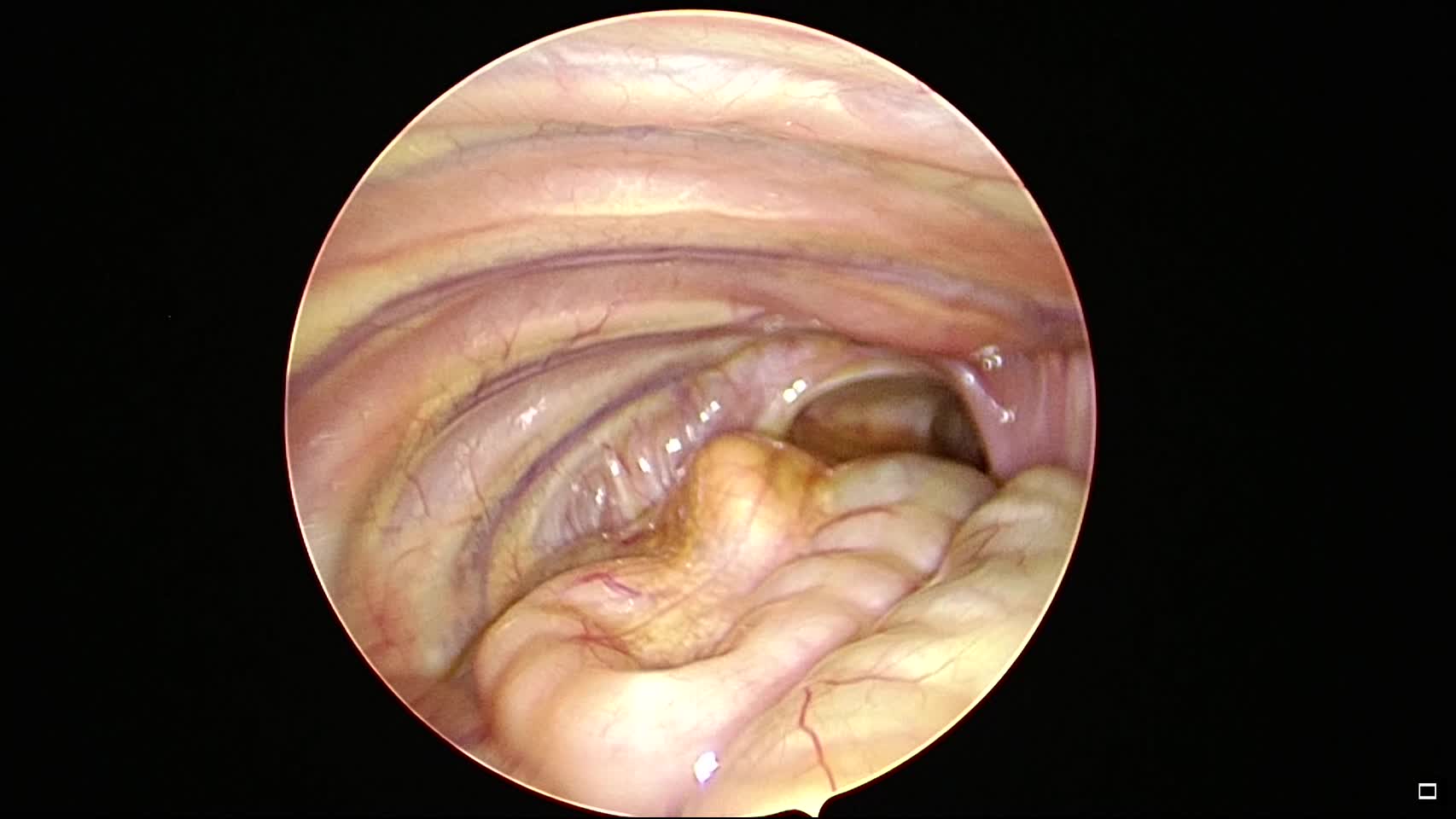（ES）4642：上村論文