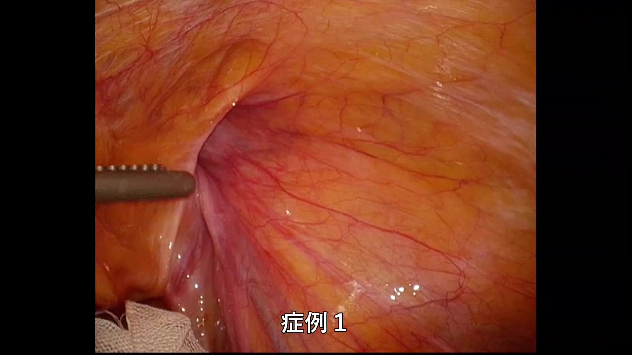 （ES）4647：山本論文