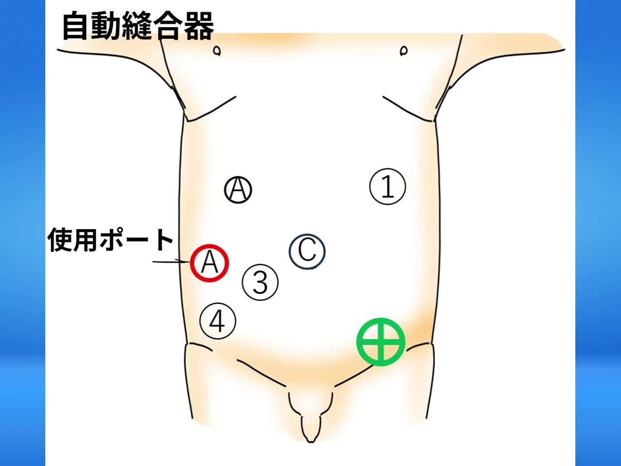 （ES）4652：東倉論文