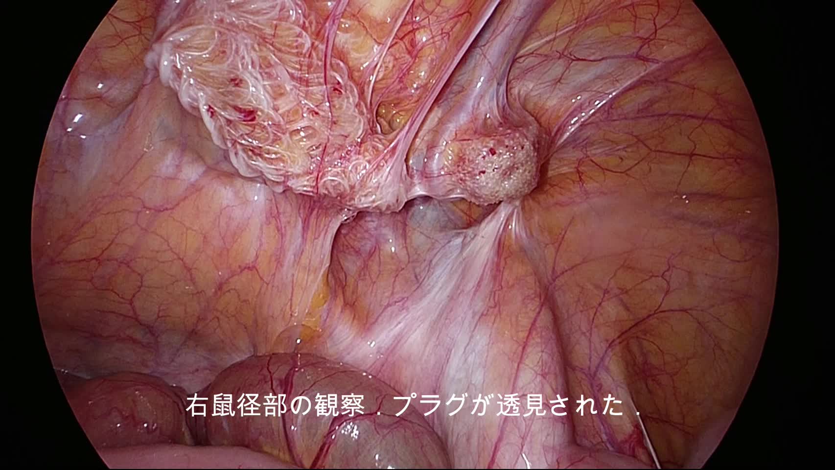 （ES）4654：赤坂論文