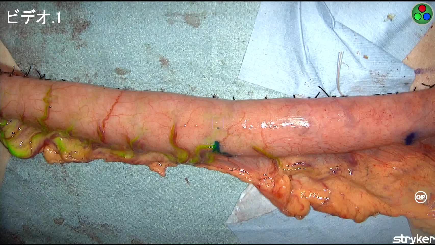 （ES）4664：久保論文