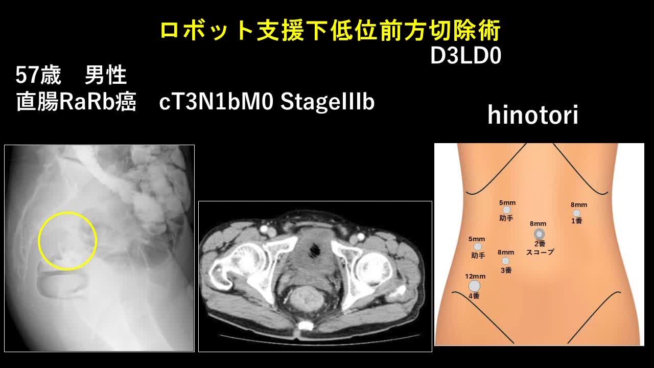 日鏡外会誌 31巻5号 私の工夫（板橋論文）...